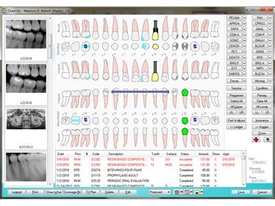 epms dental software|EDMS Dental .